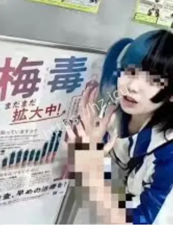 日本梅毒扩散爆料